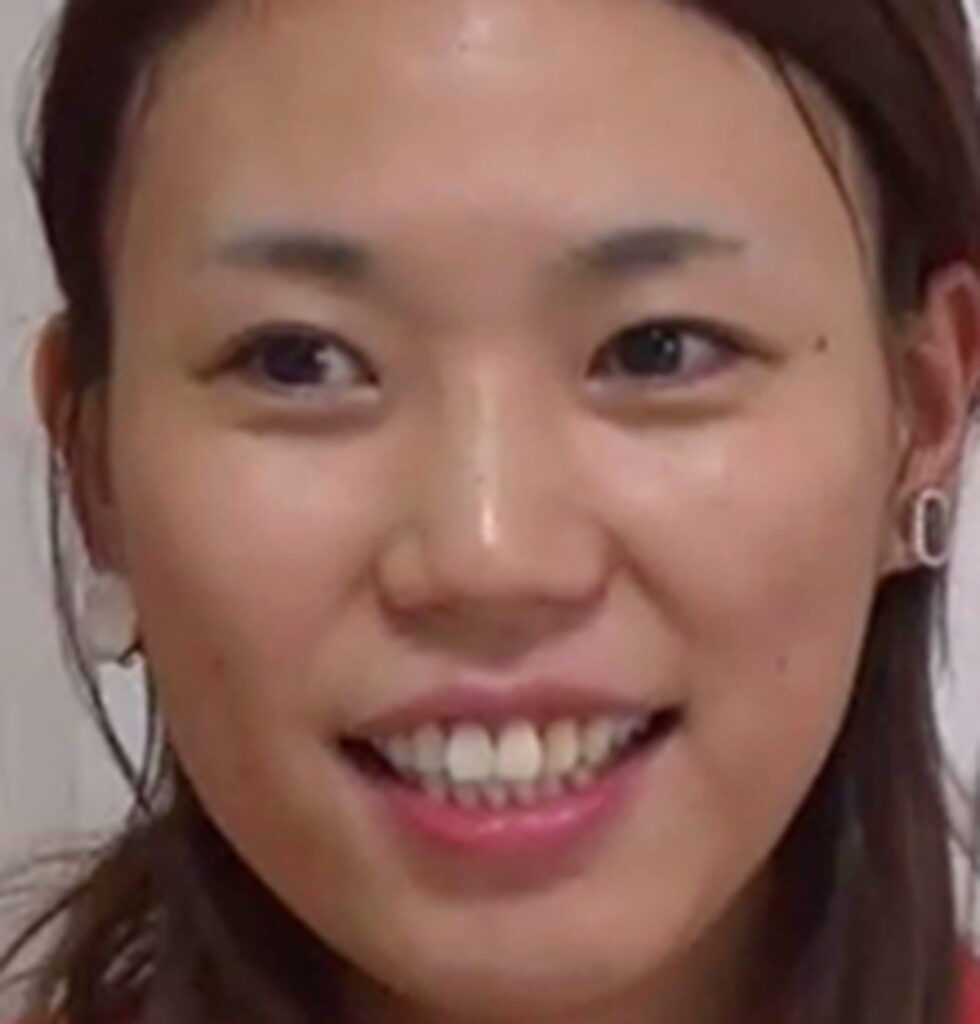 紺野ぶるま すっぴん 整形してない